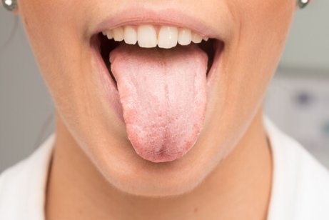 Pourquoi j’ai la langue blanche