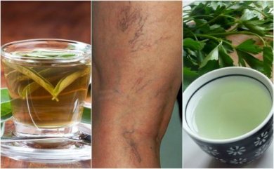 5 infusions diurétiques qui vous aideront à combattre les varices
