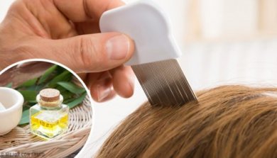 6 produits faits maison pour éliminer les poux