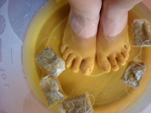 Le thé pour traiter le pied d'athlète