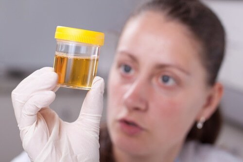 Échantillon d'urine