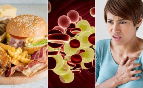 Hypercholestérolémie : pourquoi est-ce un danger pour la santé et comment réduire le risque ?