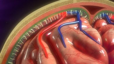 Qu'est-ce que la méningite ?