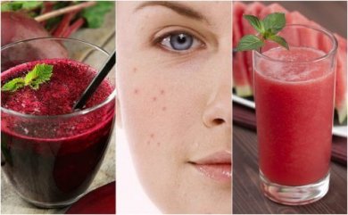 Comment combattre l'acné grâce à 5 smoothies détoxifiants