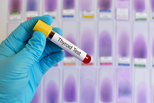 tube d'une analyse de sang pour diagnostiquer l'hypothyroïdie