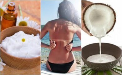 Comment soigner les coups de soleil avec 5 remèdes naturels