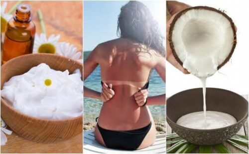 Comment soigner les coups de soleil avec 5 remèdes naturels