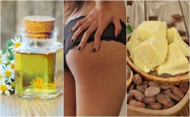 Vous voulez atténuer les vergetures de votre corps ? Notez ces 5 remèdes maison