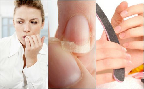 8 raisons pour lesquelles vous avez des ongles cassants 8 raisons pour lesquelles vous avez des ongles cassants