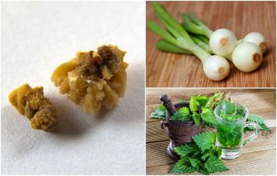 Comment combattre les calculs d'acide urique grâce à 5 remèdes naturels