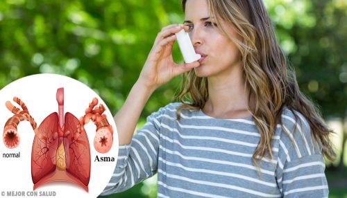 Qu'est-ce que l'asthme ?