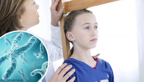 Manifestations cliniques du syndrome de Turner