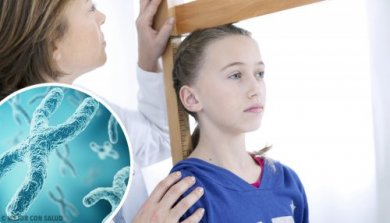 Le syndrome de Turner