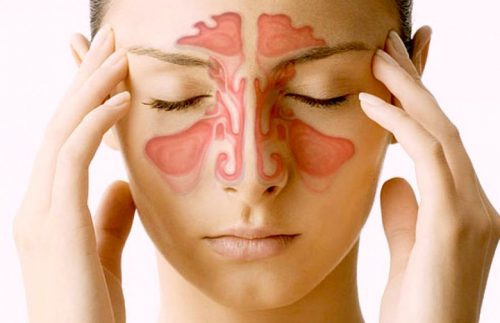Sinus paranasaux : 5 choses que nous devrions savoir