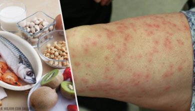 Connaître les aliments les plus allergènes et leurs substituts