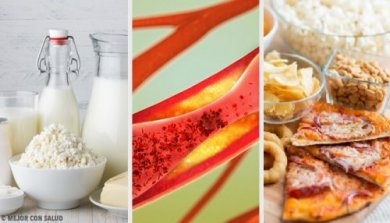 Les aliments qui obstruent les artères