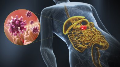 Qu'est-ce que la gastro-entérite ?