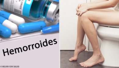 Les différents traitements des hémorroïdes