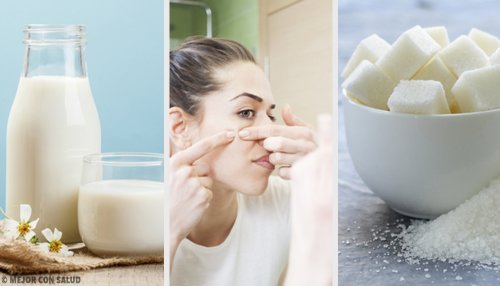 Éliminez les impuretés de votre peau avec ces 4 masques