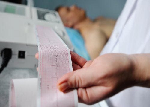 Diagnostic d'un infarctus aigu.