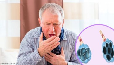 Maladie pulmonaire obstructive chronique (MPOC)