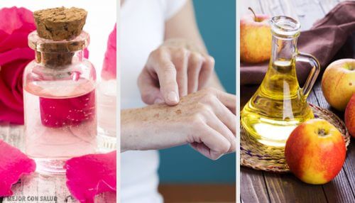 8 remèdes naturels pour faire disparaître les taches sur les mains