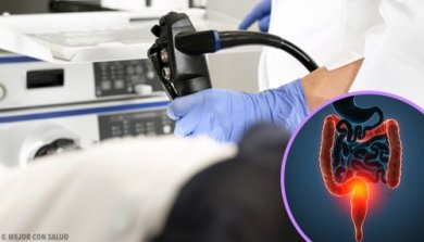 Traitement du cancer du côlon