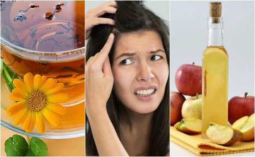 5 remèdes naturels pour apaiser le cuir chevelu sensible