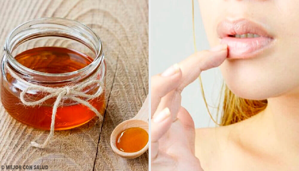 6 remèdes naturels contre les gerçures des lèvres