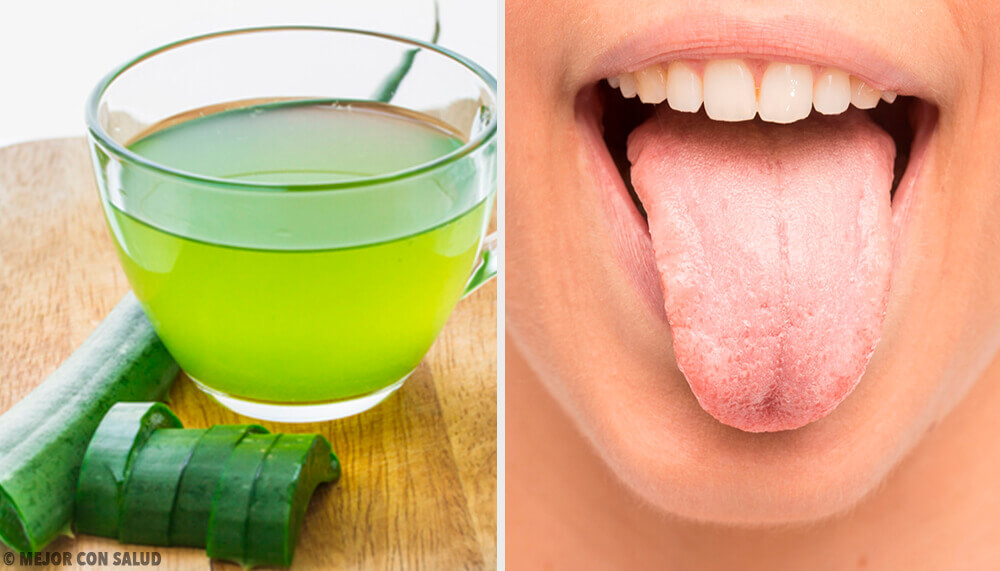 7 remèdes naturels pour lutter contre la langue blanche