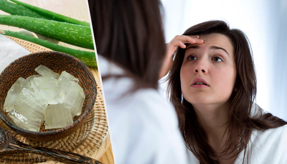 Comment utiliser l’aloe vera pour réduire les rides Comment utiliser l’aloe vera pour réduire les rides
