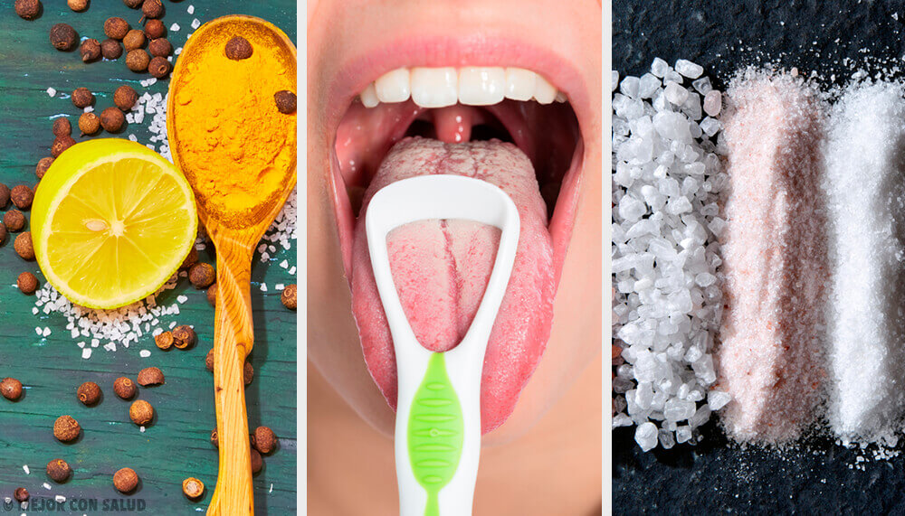 Des remèdes naturels pour traiter la langue blanche