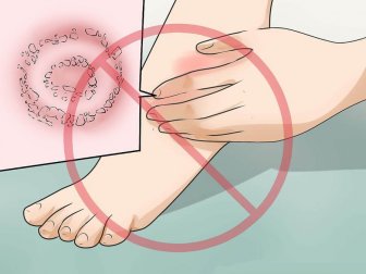 Le traitement de l'érysipèle