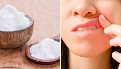 En finir avec les aphtes : quelques remèdes maison