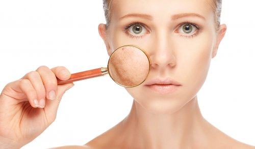 les problèmes de peau liés au diabète