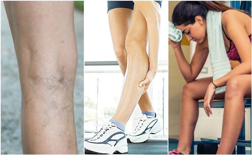 Origine des crampes.