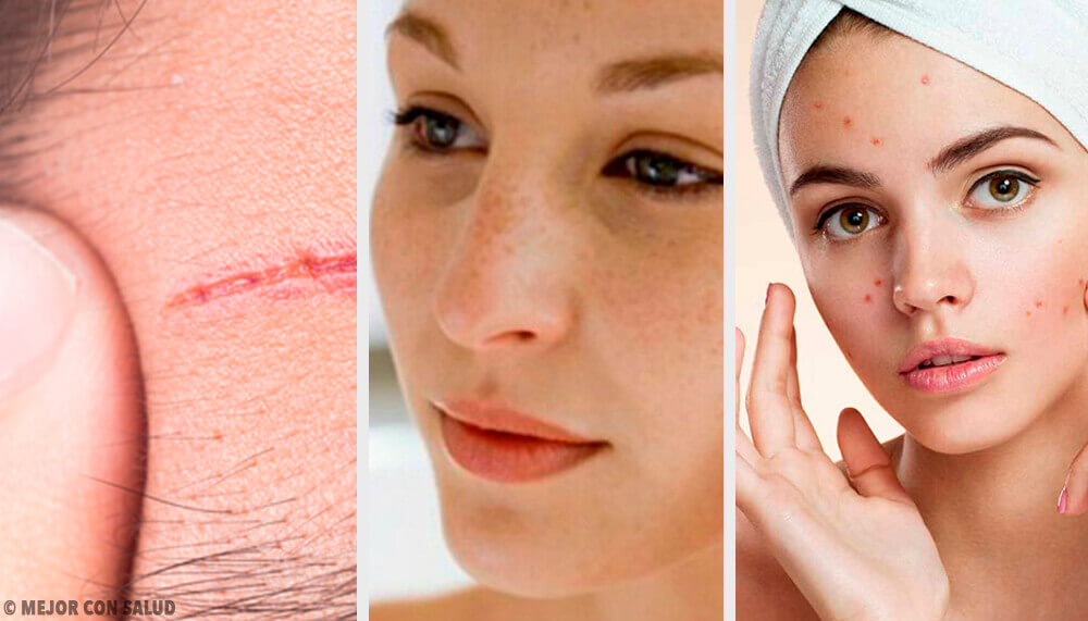 Les problèmes les plus fréquents du visage et comment les traiter