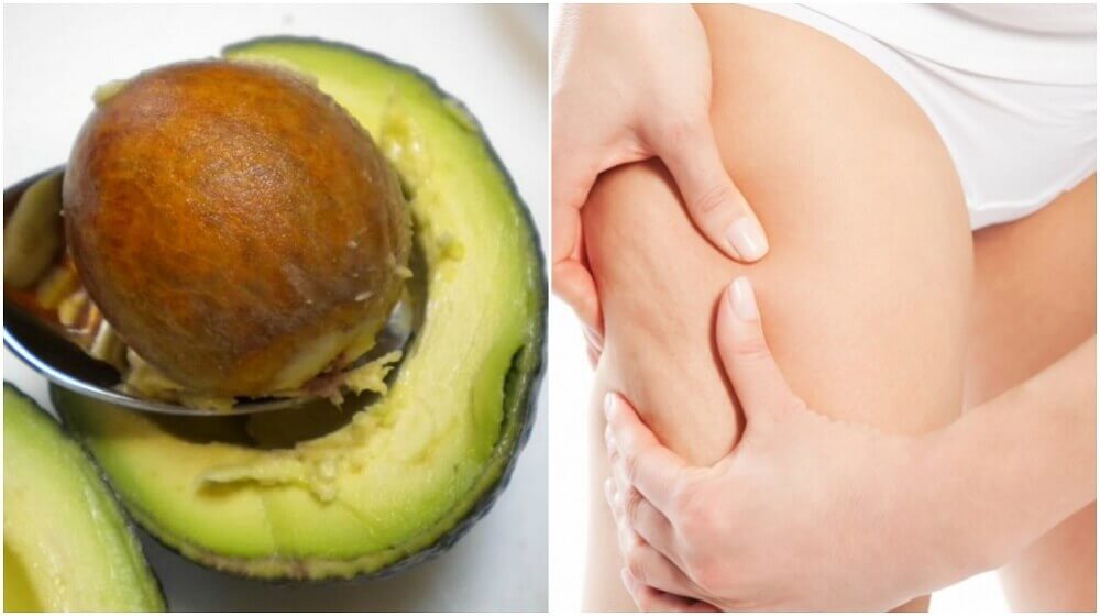 Comment utiliser le noyau d’avocat dans le traitement de la cellulite Comment utiliser le noyau d’avocat dans le traitement de la cellulite