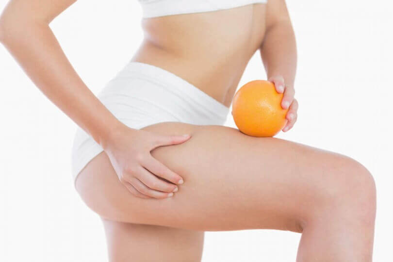 la cellulite avec