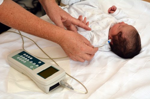 Test d'audition sur un bébé