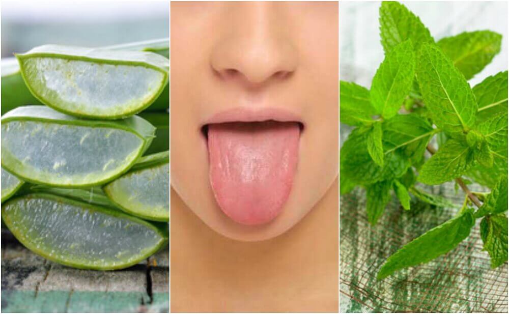 Soulager les cloques sur la langue avec 6 traitements d’origine naturelle Soulager les cloques sur la langue avec 6 traitements d’origine naturelle