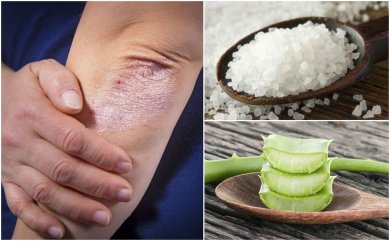 Comment combattre les champignons sur la peau avec 5 solutions naturelles