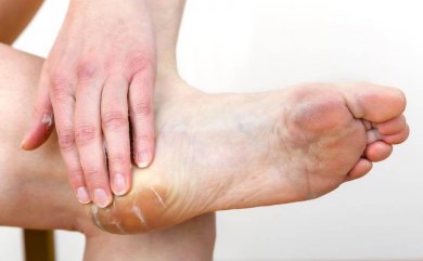 5 traitements naturels contre les cors au pied