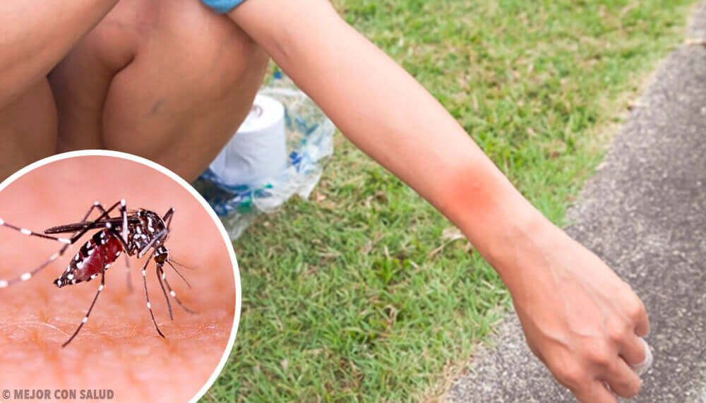Que se passe-t-il quand on gratte une piqûre de moustique ?