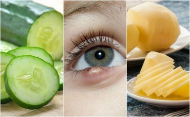 5 remèdes d'origine naturelle pour traiter les orgelets