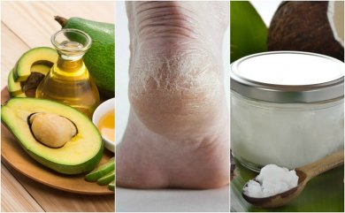 5 crèmes maison pour hydrater les talons secs
