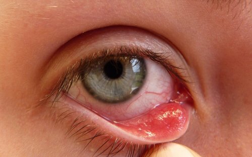Zoom sur un orgelet