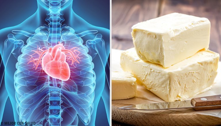 5 aliments qui affectent gravement le cœur
