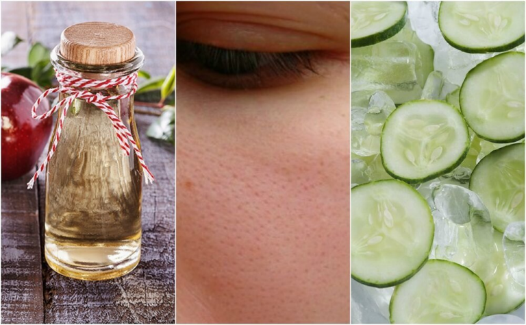 6 ingrédients naturels pour refermer les pores ouverts