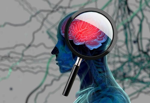 Alzheimer et perte de la mémoire immédiate